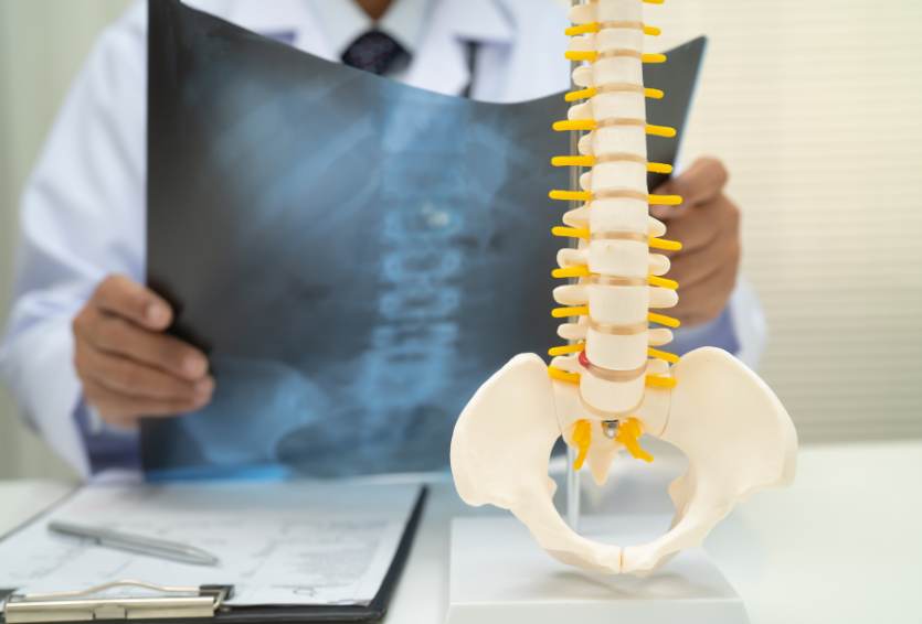 How Advanced Imaging Improves Accuracy in Spine Surgery