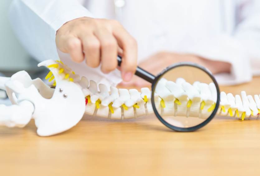 Revision Spine Surgery: Why Some Patients Need a Second Procedure