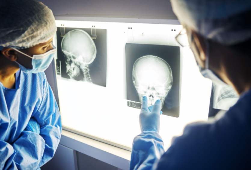 What Happens During a Craniotomy? A Step-by-Step Overview