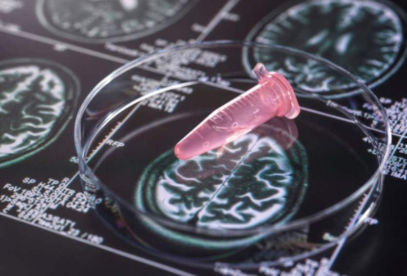 Brain Biopsy vs. Tumor Resection: Understanding the Difference