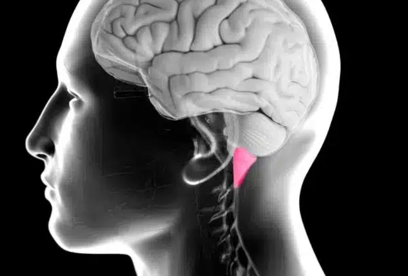 Chiari Malformation Surgery: What to Expect Before, During, and After